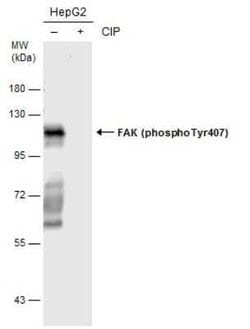FAK, p Tyr407 Antibody, Novus Biologicals 100 &mu;g; Unconjugated:Antibodies,