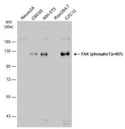 FAK, p Tyr407 Antibody, Novus Biologicals 100 &mu;g; Unconjugated:Antibodies,