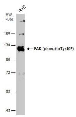 FAK, p Tyr407 Antibody, Novus Biologicals 100 &mu;g; Unconjugated:Antibodies,