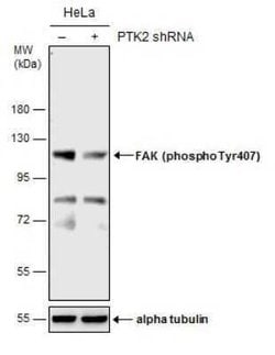 FAK, p Tyr407 Antibody, Novus Biologicals 100 &mu;g; Unconjugated:Antibodies,