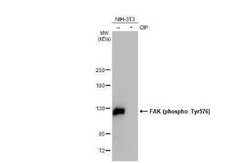 FAK, p Tyr576 Antibody (HL127), Novus Biologicals 100 &mu;g | Buy Online | Novus Biologicals | Fisher Scientific