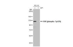 FAK, p Tyr576 Antibody (HL127), Novus Biologicals 100 &mu;g | Buy Online | Novus Biologicals | Fisher Scientific