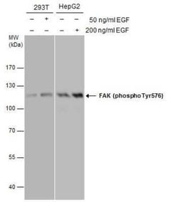 FAK, p Tyr576 Antibody, Novus Biologicals 100 μg; Unconjugated:Antibodies,