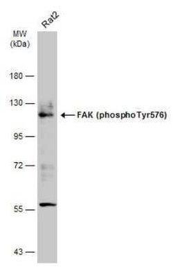 FAK, p Tyr576 Antibody, Novus Biologicals 100 μg; Unconjugated:Antibodies,