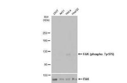FAK, p Tyr576 Antibody, Novus Biologicals 100 μg; Unconjugated:Antibodies,