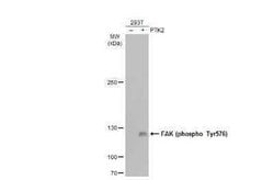 FAK, p Tyr576 Antibody, Novus Biologicals 100 μg; Unconjugated:Antibodies,
