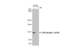 FAK, p Tyr576 Antibody, Novus Biologicals 100 μg; Unconjugated:Antibodies,