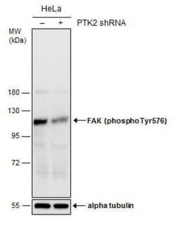 FAK, p Tyr576 Antibody, Novus Biologicals 100 μg; Unconjugated:Antibodies,