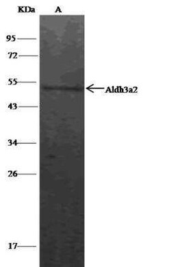 FALDH Antibody, Novus Biologicals 50 &mu;g; Unconjugated:Antibodies, Polyclonal