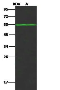 FALDH Antibody, Novus Biologicals 50 &mu;g; Unconjugated:Antibodies, Polyclonal