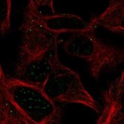 FAM108A1 Rabbit anti-Human, Polyclonal, Novus Biologicals 100 &mu;g | Buy Online | Novus Biologicals | Fisher Scientific