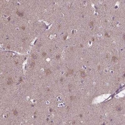 FAM114A1 Antibody, Novus Biologicals:Antibodies:Primary Antibodies