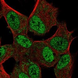 FAM124B Antibody, Novus Biologicals:Antibodies:Primary Antibodies