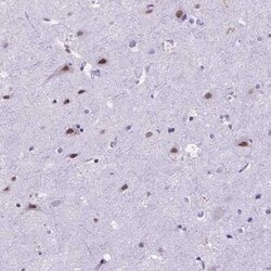 FAM124B Antibody, Novus Biologicals:Antibodies:Primary Antibodies