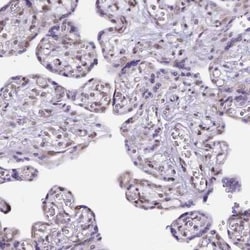 FAM124B Antibody, Novus Biologicals:Antibodies:Primary Antibodies