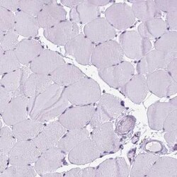 FAM124B Antibody, Novus Biologicals:Antibodies:Primary Antibodies