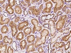 FAM151A Antibody, Novus Biologicals 100 &mu;g | Buy Online | Novus Biologicals | Fisher Scientific