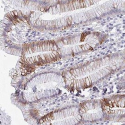 FAM156A Antibody, Novus Biologicals:Antibodies:Primary Antibodies