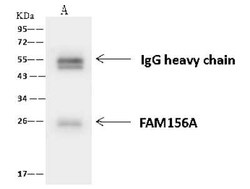 FAM156A Antibody, Novus Biologicals 50 &mu;g, Unconjugated:Antibodies,