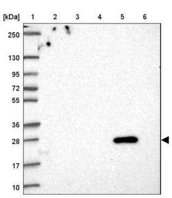 FAM156A Antibody, Novus Biologicals 25 &mu;L, Unconjugated:Antibodies,
