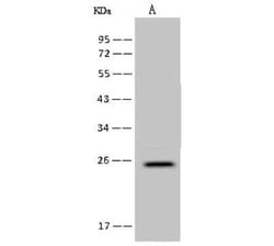FAM156A Antibody, Novus Biologicals 50 &mu;g, Unconjugated:Antibodies,