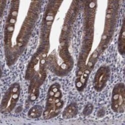 FAM158A Rabbit anti-Human, Polyclonal, Novus Biologicals 25 &mu;g; Unconjugated:Antibodies,