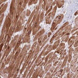 FAM184B Antibody, Novus Biologicals 25 &mu;L | Buy Online | Novus Biologicals | Fisher Scientific