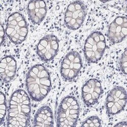 FAM187B Rabbit anti-Human, Polyclonal, Novus Biologicals 25 &mu;g; Unconjugated:Antibodies,