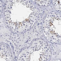 FAM187B Rabbit anti-Human, Polyclonal, Novus Biologicals 25 &mu;g; Unconjugated:Antibodies,