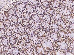FAM200A Antibody, Novus Biologicals 50 &mu;g; Unconjugated:Antibodies,