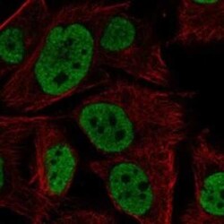 FAM211A Rabbit anti-Human, Polyclonal, Novus Biologicals 25 &mu;g | Buy Online | Novus Biologicals | Fisher Scientific