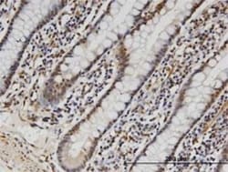 FAM3B Antibody (1E7), Novus Biologicals 0.1 mg, Unconjugated:Antibodies,