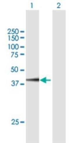 FAM46C Antibody, Novus Biologicals 0.05 mg, Unconjugated:Antibodies, Polyclonal
