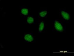 FAM47B Antibody, Novus Biologicals 50 &mu;g | Buy Online | Novus Biologicals | Fisher Scientific