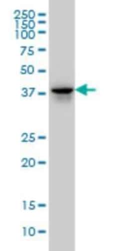 FAM50A Antibody (5F10), Novus Biologicals 0.1 mg | Buy Online | Novus Biologicals | Fisher Scientific