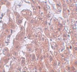 FAM59A Antibody - BSA Free, Novus Biologicals 0.1 mg | Buy Online | Novus Biologicals | Fisher Scientific