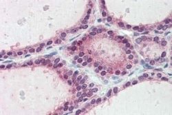 FAM62A Antibody, Novus Biologicals 50 &mu;g | Buy Online | Novus Biologicals | Fisher Scientific