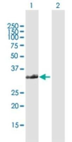 FAM64A Antibody, Novus Biologicals 0.1 mg | Buy Online | Novus Biologicals | Fisher Scientific