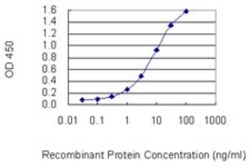 Novus Biologicals FAM65B Antibody (2E6-1B10), Novus Biologicals 0.1 mg | Buy Online | Novus Biologicals&trade; | Fisher Scientific