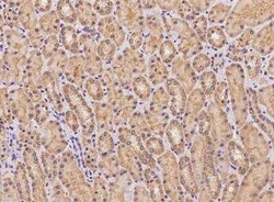 FAM83F Antibody, Novus Biologicals:Antibodies:Primary Antibodies