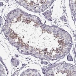 FAM92A1 Antibody, Novus Biologicals 25 &mu;L; FAM92A1 Antibody; Unconjugated:Antibodies,