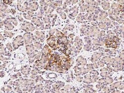 FANCC Antibody, Novus Biologicals:Antibodies:Primary Antibodies
