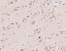 FANCC Antibody, Novus Biologicals:Antibodies:Primary Antibodies