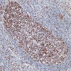 FANCD2 Antibody (1290D) - Azide and BSA Free, Novus Biologicals 0.1 mg;
