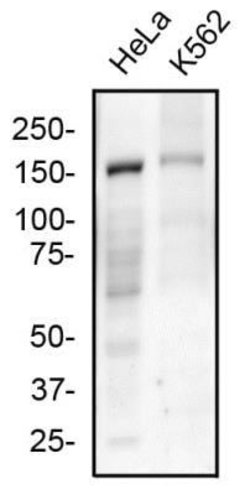 FANCD2 Antibody (1290D) - Azide and BSA Free, Novus Biologicals 0.1 mg;