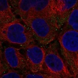 FANCD2OS Rabbit anti-Human, Polyclonal, Novus Biologicals 100 &mu;g; Unconjugated:Antibodies,