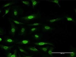 FANCF Antibody, Novus Biologicals 0.05 mg, Unconjugated:Antibodies, Polyclonal
