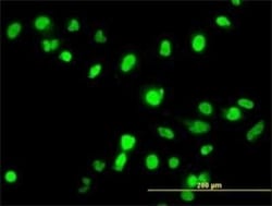 FANCG Antibody (2C8), Novus Biologicals 0.1 mg | Buy Online | Novus Biologicals | Fisher Scientific