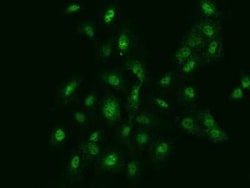 FANCG Antibody, Novus Biologicals 50 &mu;g, Unconjugated:Antibodies, Polyclonal