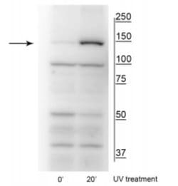 FANCI, p Ser556 Antibody, Novus Biologicals 100&mu;L:Antibodies, Polyclonal